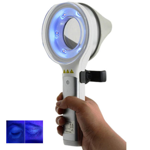 피부 질환 탈색 및 과색소침착 검사 및 진단용 Kern - Led Medical Headlight 리뷰 및 가격